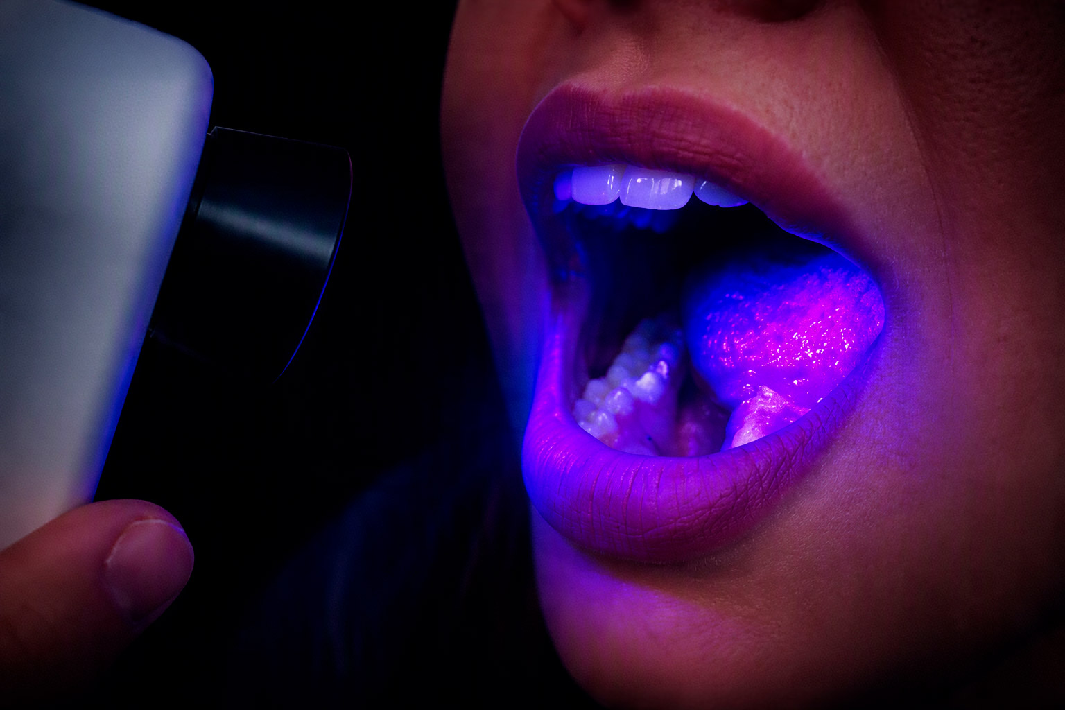 Imagem com fluorescência do EVINCE